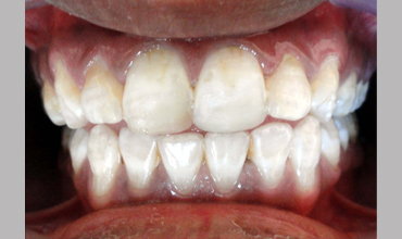 Dental care in Anand
                        